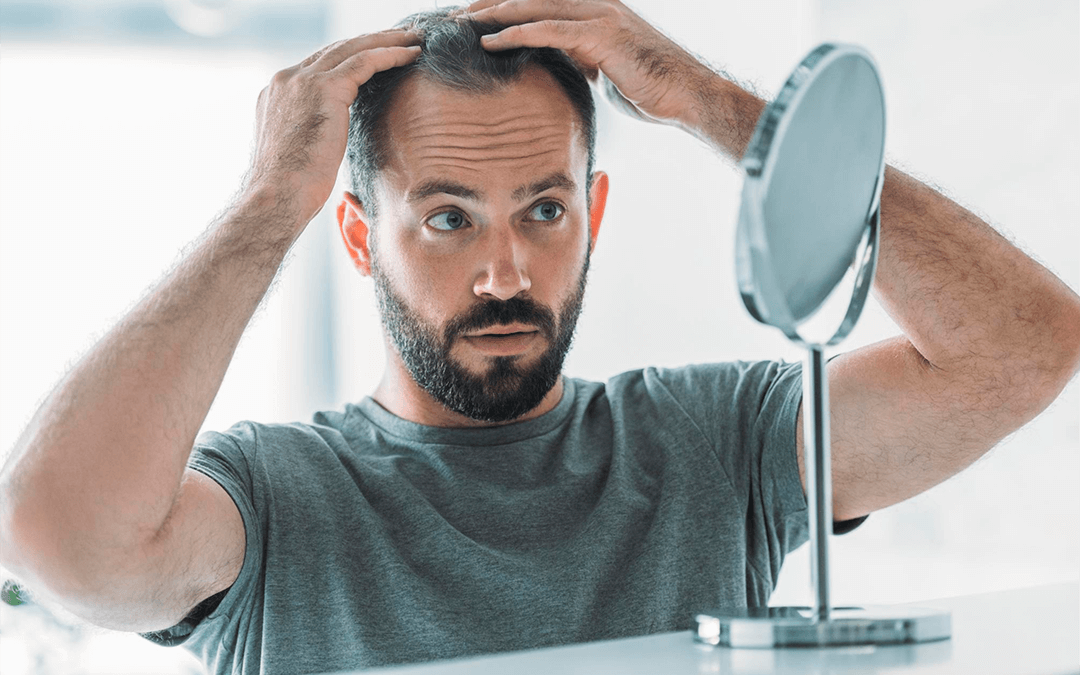 Prevention: Your Best Ally for Hair Loss